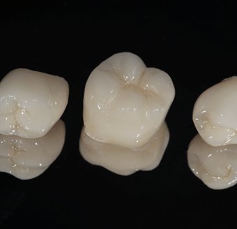 Three white dental crowns on black background