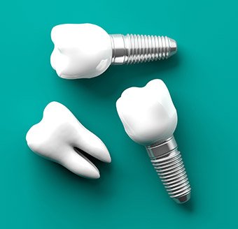 Animation of tooth and implant supported dental crown