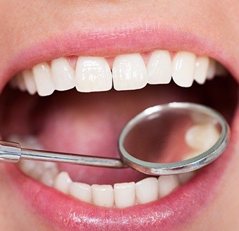 Closeup of healthy smile